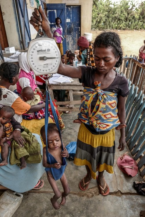 Barn vigtað á heilsugæsustöð í suðurhluta Madagaskar Mynd: UNICEF